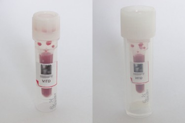 Vitamin D Test Blutbehälter